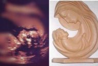Hình ảnh kỳ diệu của Đức Mẹ bế em bé xuất hiện trên siêu âm